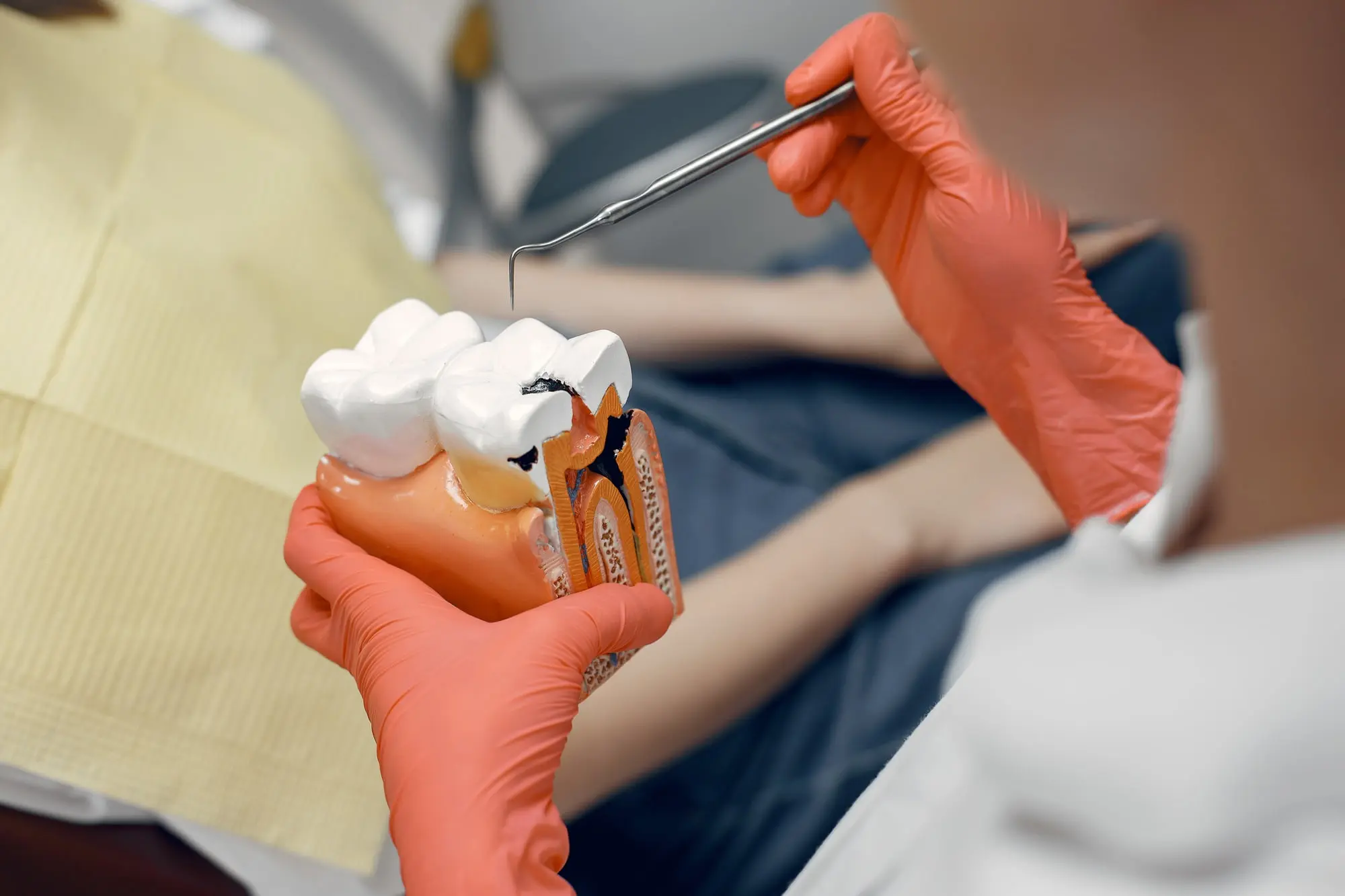 At Pediatric Dentistry and Orthodontics of Forsyth - Cumming in Cumming, GA. A dentist wearing orange gloves uses a dental tool to indicate a cavity on a large tooth model, emphasizing the role of dental sealants in preventing cavities while a patient sits nearby.