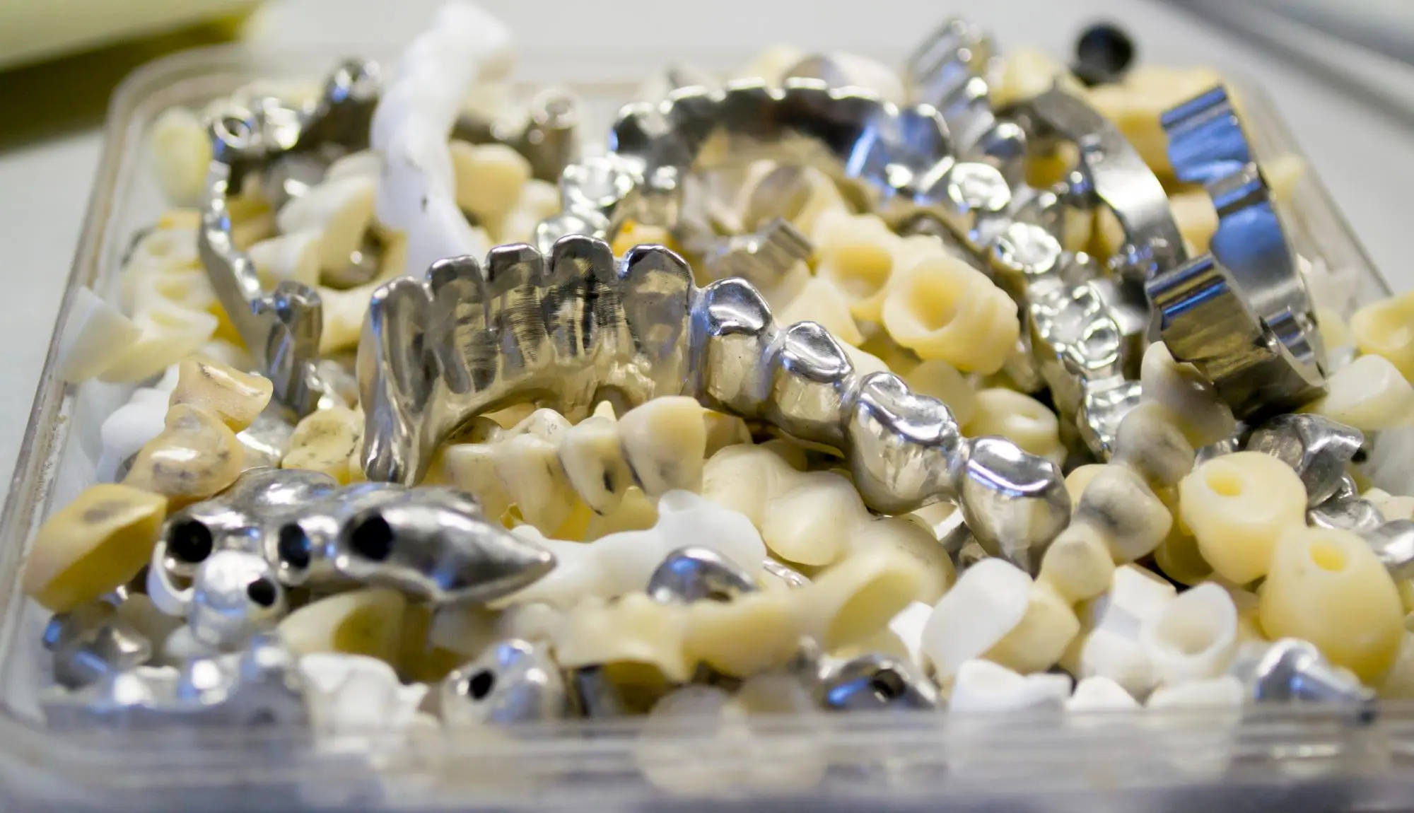 A container holds various dental prosthetics at At Pediatric Dentistry and Orthodontics of Forsyth - Cumming in Cumming GA, including zirconia and stainless-steel crowns for restorative pediatric care, along with ceramic and metal dental bridges.