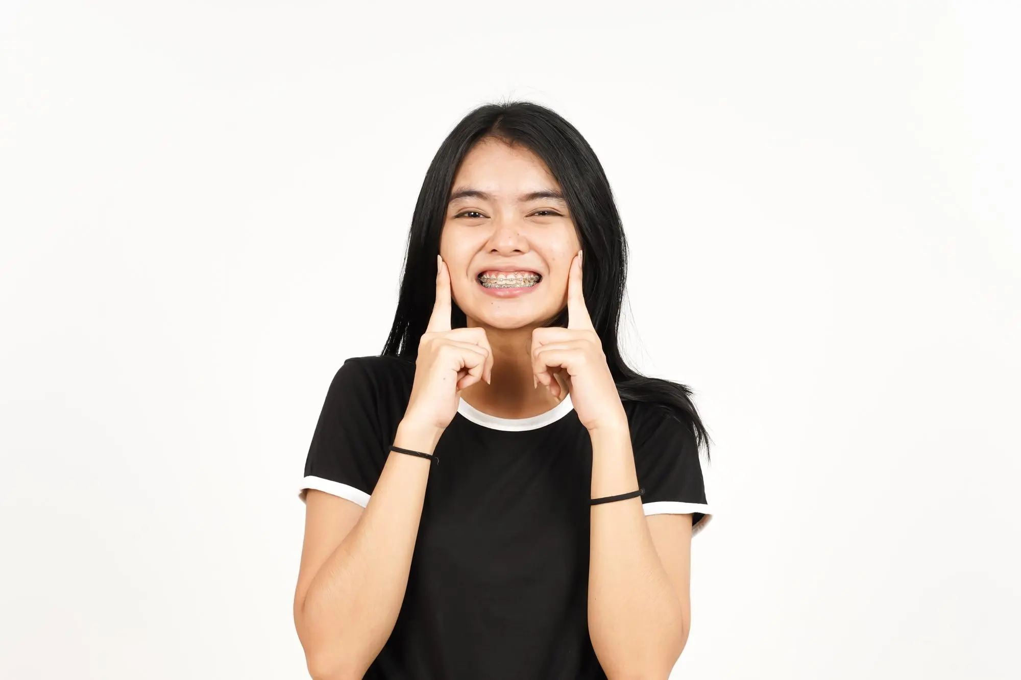 Smiling teen with braces points to her cheeks, promoting underbite treatment from Forsyth Pediatric Dentistry and Orthodontics in Cumming, GA.