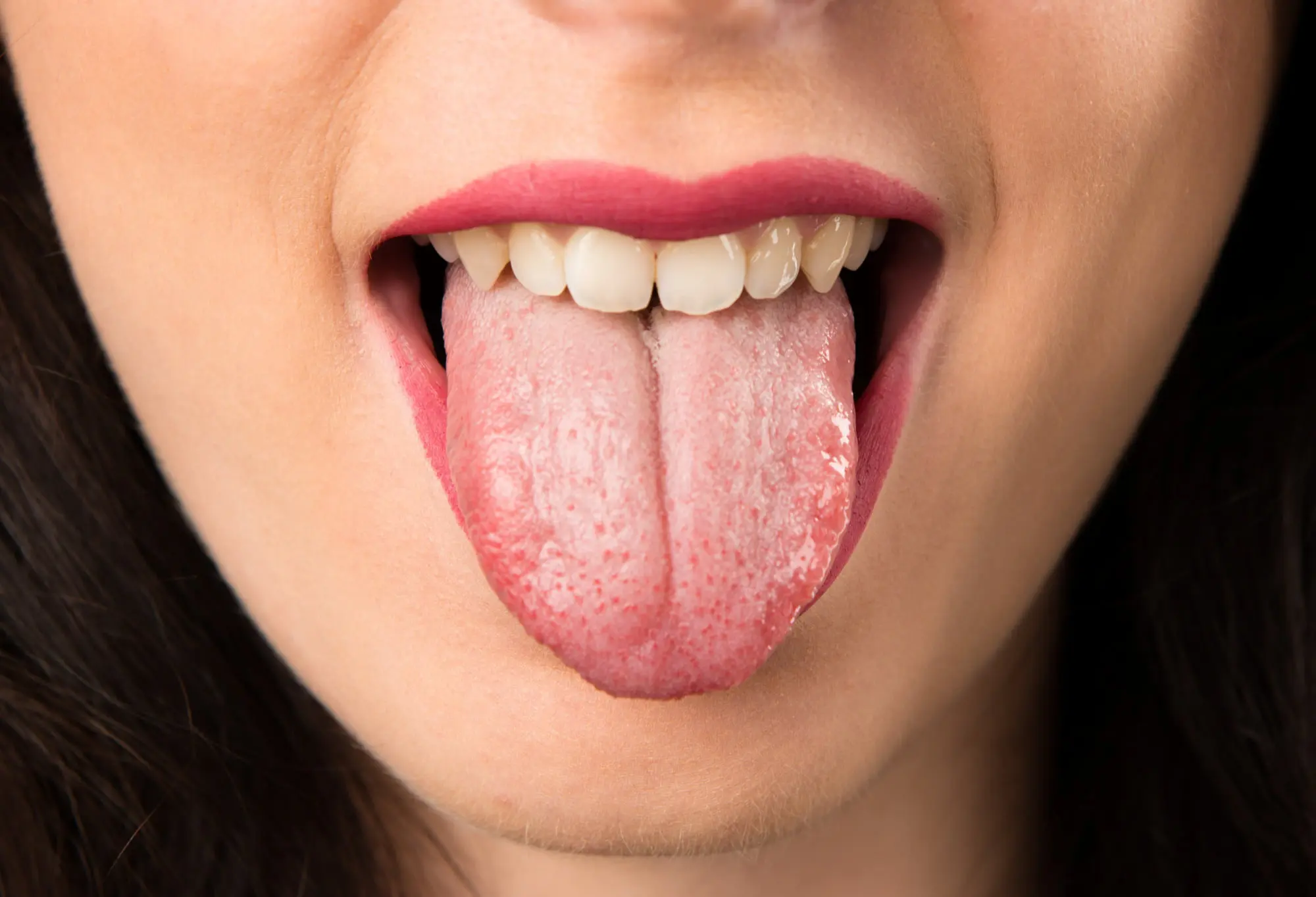 A playful close-up represent relationship between mouth breathing and dry mouth cause mouth breather at Forsyth Pediatric Dentistry and Orthodontics in Cumming, GA: woman with red lipstick sticks out her tongue.