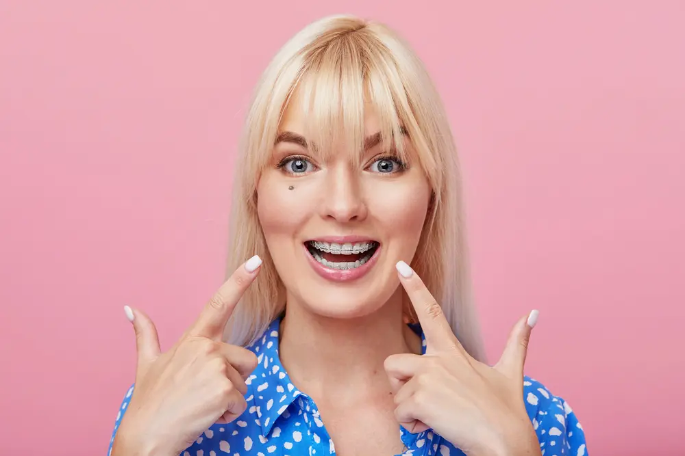 Smiling woman with long blonde hair points to clear braces, promoting Pediatric Dentistry and Orthodontics of Forsyth - Cumming in Cumming, GA.