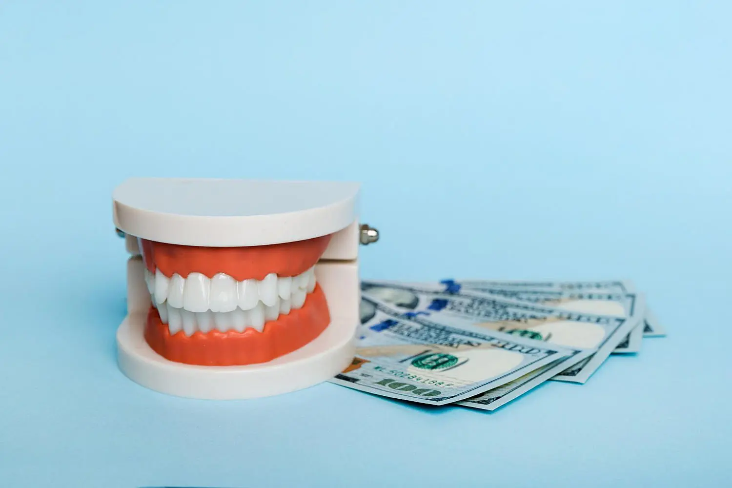 A dental model with clear braces sits beside hundred dollar bills on blue, highlighting Pediatric Dentistry and Orthodontics of Forsyth - Cumming in Cumming, GA.