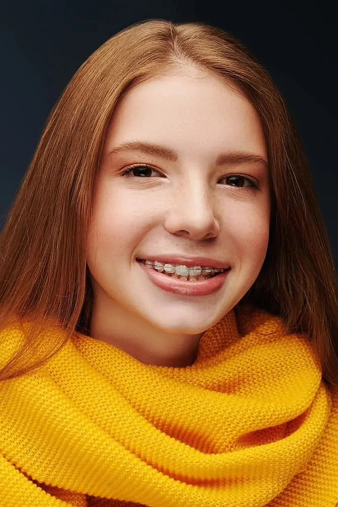 Smiling teen girl with long light brown hair and yellow scarf shows her ceramic braces, representing Pediatric Dentistry and Orthodontics of Forsyth - Cumming in Cumming, GA.