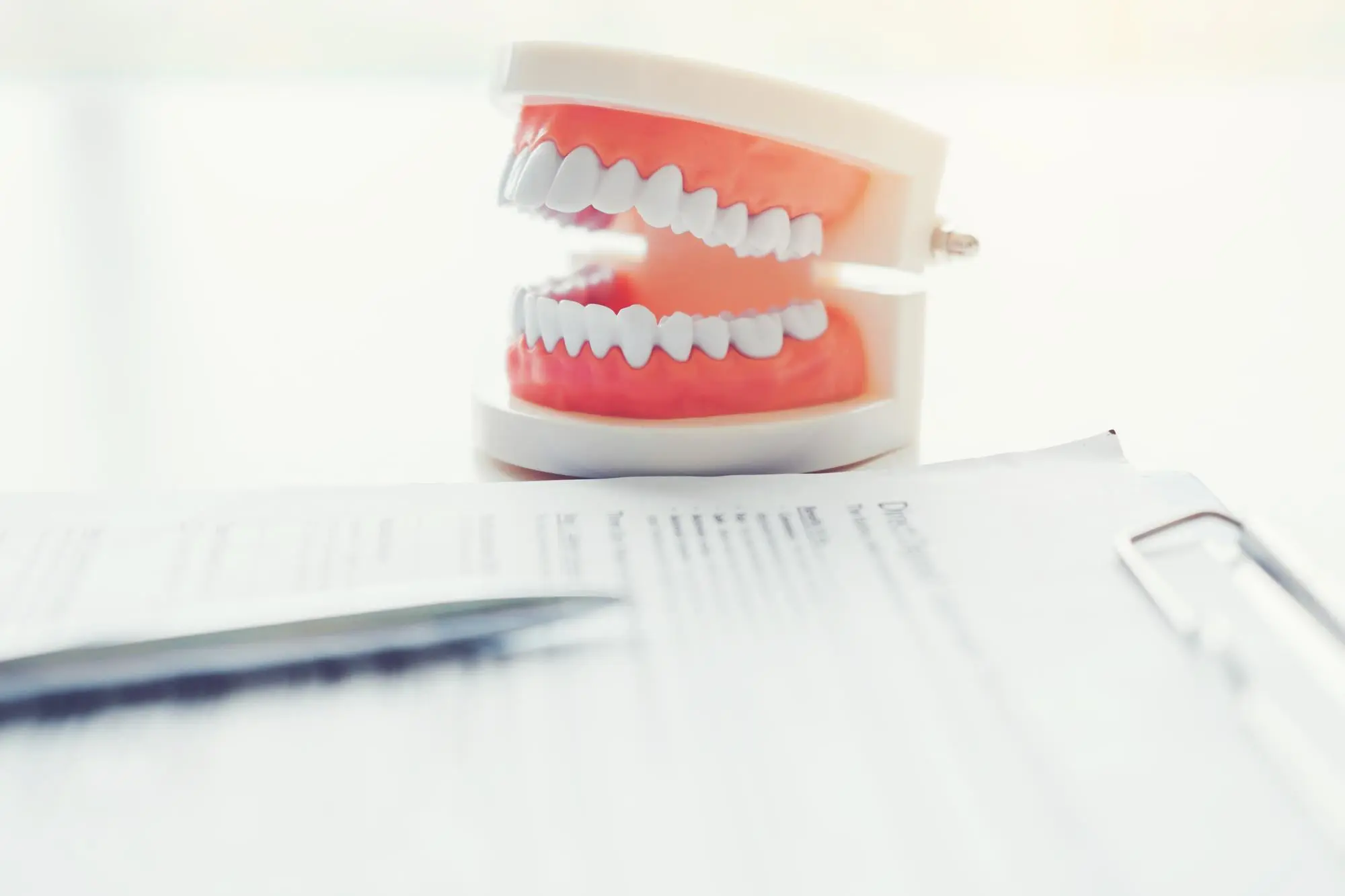 On a desk at Forsyth Pediatric Dentistry and Orthodontics in Cumming GA, a dental model with a Herbst Appliance sits by a clipboard.