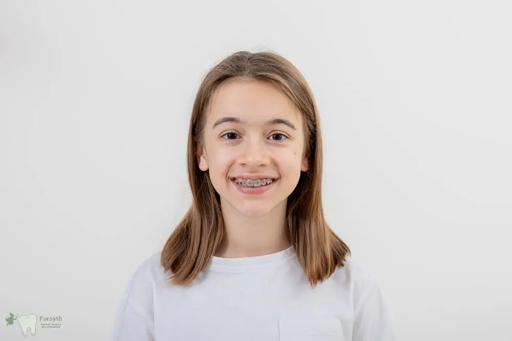Smiling with braces, a young person in a white shirt at Forsyth Pediatric Dentistry and Orthodontics in Cumming, GA - Braces for Teens in Cumming: What Parents Should Know 
