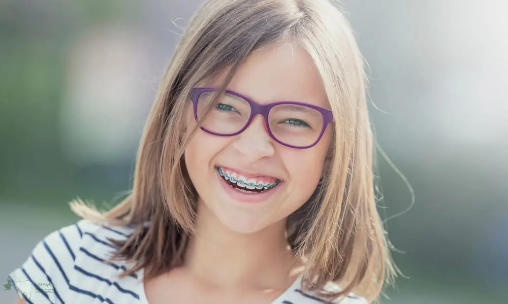 A smiling child with straight hair, glasses, and braces stands outdoors in a striped shirt for Forsyth Pediatric Dentistry and Orthodontics in Cumming, GA - Tooth-Friendly Snacks for Kids: Dentist Recommendations from Cumming, GA